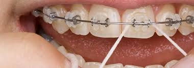 Cavity symptoms or signs of tooth decay can include sensitivity to heat, cold, or sweet foods. Best Toothpaste Mouthwash Floss Orthodontic Kits For Braces Electric Teeth
