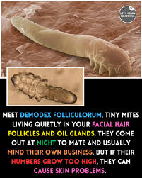 Image result for Demodex folliculorum