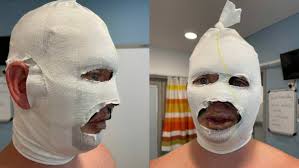 Help needed as former Wagga resident Grant Daly recovers from bonfire  explosion