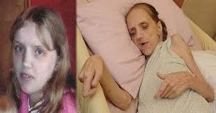 Beverly var en alkoholisert ung mor. Hun ble bare 36 år gammel. Nå advarer  kjæresten.