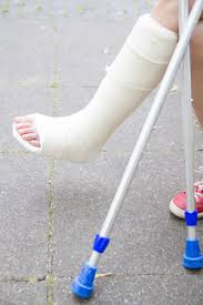 Check spelling or type a new query. Orthokids Casts And Splints