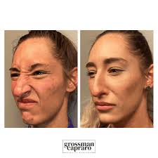 Gallery Of Botox Denver| Greenwood Village