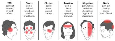 Headache Diagram Location Headache Diagram Tension Headache