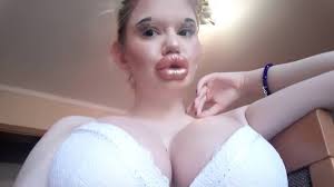 OnlyFans Star, Andrea Ivanova with Worlds Biggest Lips Goes for Four  Times Bigger Boobs! View HOT Pics and Videos of the Bulgarian Model | 👍  LatestLY