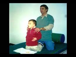 Search only for pallister killian Sindrome Pallister Killian Youtube
