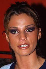 After she was forced to spit out some of her teeth before jetting off. Katie Price Nice Teeth Pretty Teeth Teeth