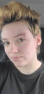 Soooo .. changed to a hoop after waiting four months. Does it suit my face?  Or go back to two studs?