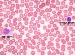 Pin On Lab Tests Prep