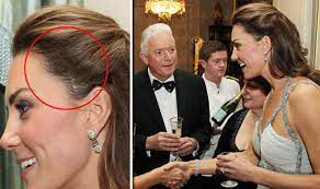 See all the latest news, pictures, beauty and fashion choices from kate middleton, now known as catherine, the duchess of cambridge following her. Kate Middleton The Reason Why The Duchess Of Cambridge Has A Scar Royal News Express Co Uk