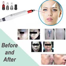 It will not cause further damage your skin. Pico Laser Machine Nd Yag Laser Tattoo Removal For Lip Lines Removal Age Spots Freckle Removal Ce Approved Beauty Equipment From Slimmingmachine8 2 037 11 Dhgate Com