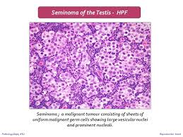Gross appearance, vascular supply, innvervation, spermatic cord. Reproduction Block Pathology Practicals Ppt Download