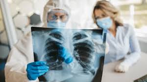 Maybe you would like to learn more about one of these? ØµÙˆØ±Ø© ØªØ¸Ù‡Ø± Ø§Ù„ÙØ±Ù‚ Ø¨ÙŠÙ† Ø±Ø¦ØªÙŠ Ù…Ø±ÙŠØ¶ ÙƒÙˆØ±ÙˆÙ†Ø§ Ù…Ù„Ù‚Ø­ ÙˆØ¢Ø®Ø± Ù„Ù… ÙŠØªÙ†Ø§ÙˆÙ„ Ø§Ù„Ù„Ù‚Ø§Ø­ Ø¬Ø±ÙŠØ¯Ø© Ø§Ù„ØºØ¯