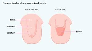 Below you will find educational and informational images of various conditions affecting men, including both normal and abnormal. Baby Circumcision Benefits Risks And What To Expect