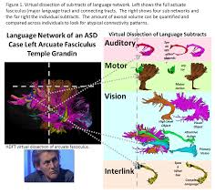 Asperger syndrome and other terms // the national autistic society. 60 Minutes Schneider Lab