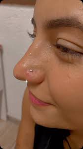 ♥️🔥É ela! Garota de atitude! Furinho de aba nasal. Ficou bem delicadinho e  gracinha pra Marina @mariina_veiga. , 🤗Todas as perfurações são realizadas  com a técnica de Acupuntura e localização do ponto ...