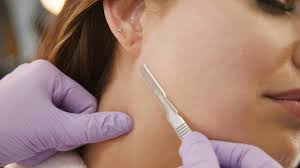 Check spelling or type a new query. What Is Dermaplaning And Why Should You Try It Today