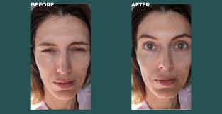 IV Therapy in Midland