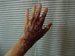 (this one follows your suggestion). Burn Makeup With Liquid Latex 3 Steps With Pictures Instructables