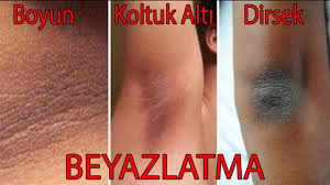 koltuk alti kararmasi nasil gecer kadinlar kulubu bellona koltuk takimi