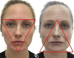 UNIVERSIDADE FEEVALE VÂNIA CHRISTINA DE ARAÚJO ÁCIDO HIALURÔNICO INJETÁVEL  E SUAS POSSÍVEIS COMPLICAÇÕES COMO PREENCHED