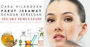 7 tips menghilangkan parut jerawat dengan berkesan dan mudah!! Cara Hilangkan Parut Jerawat Yang Berkesan Secara Natural Amizah Azid