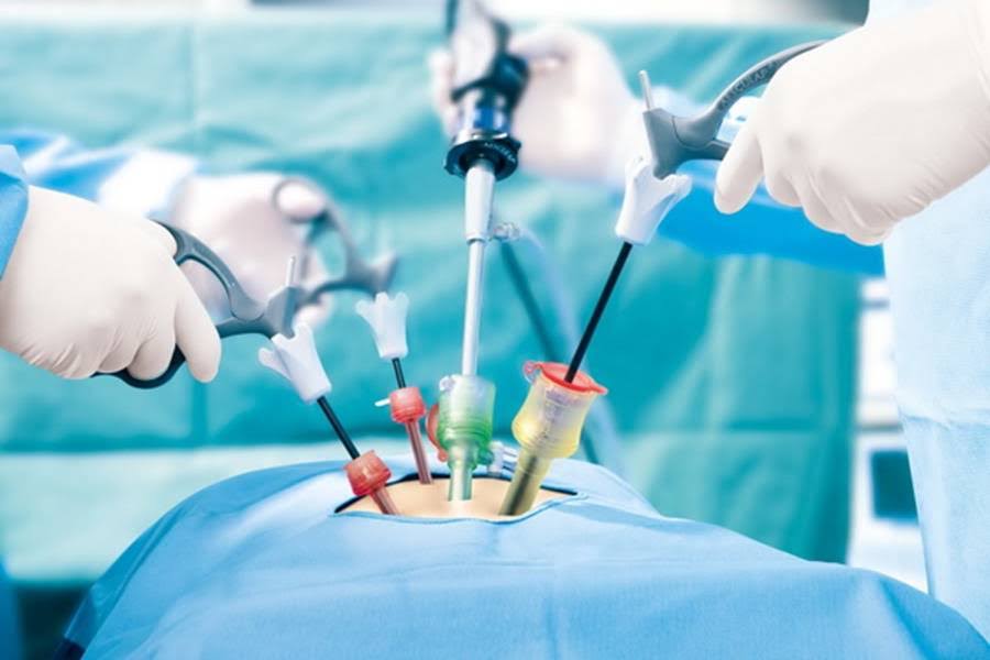 Laparoscopic Urosurgery product image