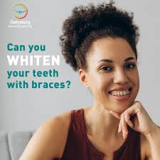 It's officially Dental Hygienist Week, and we want to share a huge shoutout  to our wonderful and talented Dental Hygienists. Kerri Owens, Jessica  Layton, Tatyana Reznikov, Lori Jansen, Stefanie Gentzler, Lori Kane,