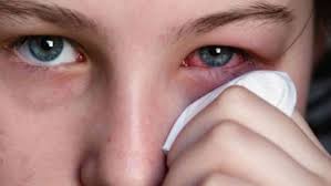 Gangguan mata yang samar juga bisa tanda penyakit yang serius pada mata. 8 Gejala Baru Covid 19 Sakit Mata Hingga Masalah Pencernaan