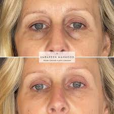 Profile for Dr. Umbareen Mahmood