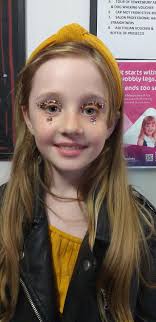 Ataxia-Telangiectasia A-T Society