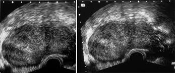 Der ultraschall beziehungsweise die sonographie (nach der neuen schreibweise auch sonografie) ist ein vielfältig eingesetztes bildgebendes verfahren in der medizin. Barmherzige Bruder Ultraschall