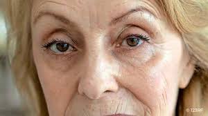 lucas smit, Author at Elzen Kliniek