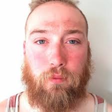 Stream Marcus 'Void' Melville music