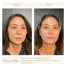 Danielle Cota-Robles RN, BSN (@dani.aesthetics.az) • Instagram photos and  videos