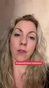 Endometrioma treatment: alcohol/ethanol sclerotherapy  https://pubs.rsna.org/doi/full/10.1148/radiol.2018180606 #endometriosis  #endometrioma #ovariancysts #chocolatecysts
