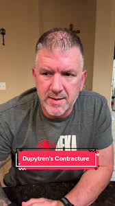 Tuesday Carpenter Release Surgery