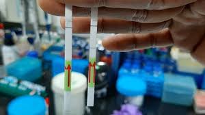 Dieser corona virus antigen schnelltest. India S New Paper Covid 19 Test Could Be A Game Changer Bbc News