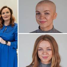 The inspirational Whitley Bay alopecia sufferer who has become the face of  The Wonderful Wig Company