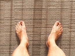 Image result for Clubbing nails feet