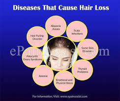 Either way, alopecia areata is one of the top 3 scalp disorders that causes hair loss. Diseases That Cause Hair Loss Hairlosswomencauses Hair Loss Alopecia Help Hair Loss Rapid Hair Loss