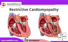 Image result for Restrictive Cardiomyopathy