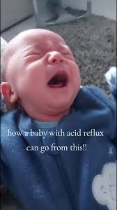 How a baby can go from a screaming baby to a very happy baby with a bit of  medication!! is amazing. #omeprazol #acidreflux