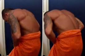 Résultat de recherche d'images pour "penis degloved"