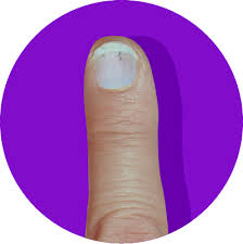 What These 8 Fingernail Textures And Colors Say About Your