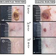 Pdf Diclofenac Topical Gel In Excisional Wounds Maintain Heal Quality And Reduce Phlogistic Signals