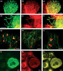 Averigua lo que blancaflor aparicio (blancaflora) ha descubierto en pinterest, la mayor colección de ideas del mundo. Microtubules In Viral Replication And Transport Niehl 2013 The Plant Journal Wiley Online Library