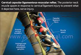Chronic Muscle Spasms And Tightness Can Indicate You Have A Ligament  Problem, Not A Muscle Problem – Caring Medical Florida