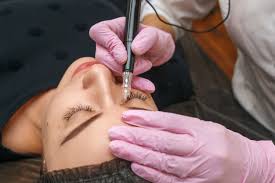 Should You Get Pigmentation Removal Treatment Browz