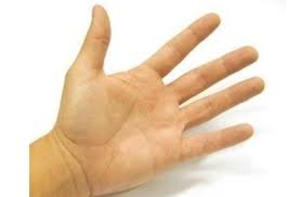 When im cold, my hands go really pale and sometimes blue. Yellow Spots On Hands