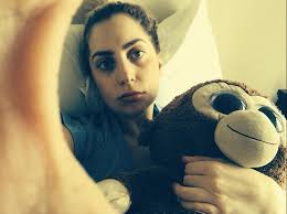 Check spelling or type a new query. Coping With Post Wisdom Teeth Surgery Chipmunk Cheeks